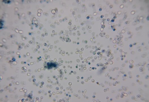 craft beer under the microscope