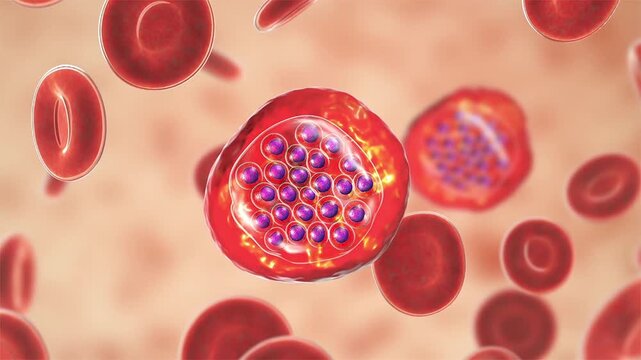 Plasmodium falciparum schizont stage, 3D animation showing mature intraerythrocytic schizont containing multiple merozoites within an infected red blood cell in falciparum malaria.