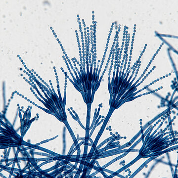 Microscopic observation of Penicillium mold