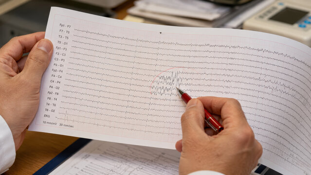 Epilepsy, EEG. Close-up of a doctor hands holding a long printed EEG paper strip showing brain wave tracings. Generative AI