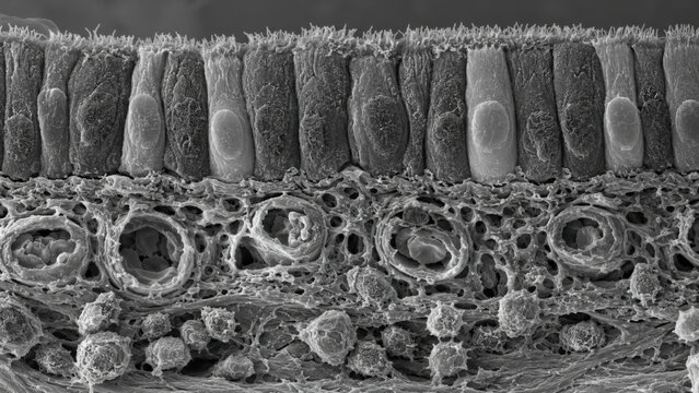Cross section of sac epithelium showing dark and light cell types in luminal lining with capillary plexus below and immune cell infiltrate in connective tissue under scanning electron microscopy