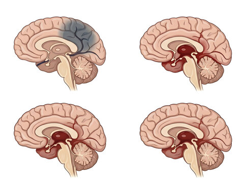 Human brain sagittal sections with highlighted regions isolated on white background