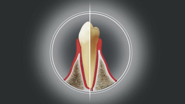 Conceptual 3D animation showing progression of gum disease, Gingivitis vs Healthy Gums, Dental treatment comparison.