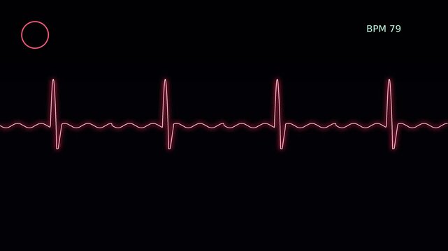 Ekg heartbeat monitor display with fluctuating bpm pulse rate animation