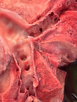 Heart dissection with trachea and arteries
