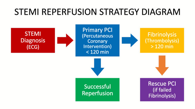 STEMI ST Elevation Myocardial Infarction Reperfusion Strategy Diagram