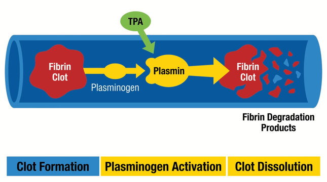Fibrinolysis Plasmin Clot Dissolution Thrombolysis Diagram