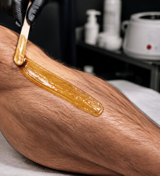 Cosmetologist applying sugar wax on man leg for hair removal. Professional shugaring procedure in beauty salon. Skin care treatment for smooth body. Epilation and depilation concept.