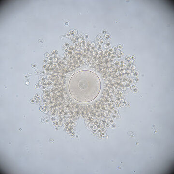 Microscope view of cumulus oocyte complex in culture