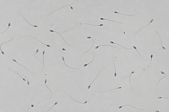 Microscopic sperm cells for fertility and reproduction concept