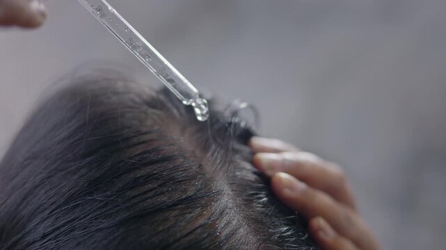 Close up shot of a woman applying hair oil to her scalp with a dropper at home, hair care concept.