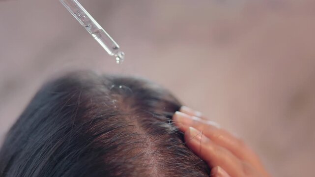 Close up shot of a woman applying hair oil on scalp with a dropper and massaging with fingers indoor, hair care concept.