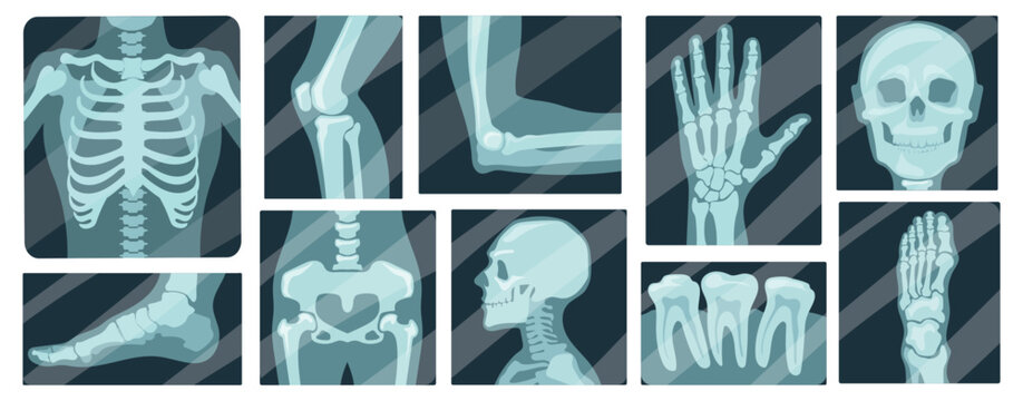X ray radiography. Bone skeleton anatomy medical scan, arm leg foot hand knee elbow joint fracture hospital diagnosis treatment surgery human body health neat vector illustration