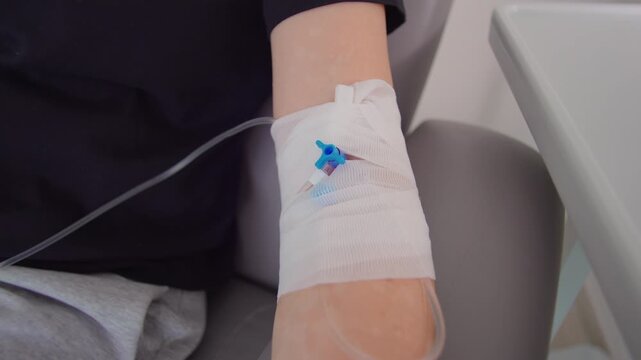 Close up of intravenous catheter in patient arm during medical treatment session, healthcare procedure detail illustrating clinical care, recovery, treatment and wellness