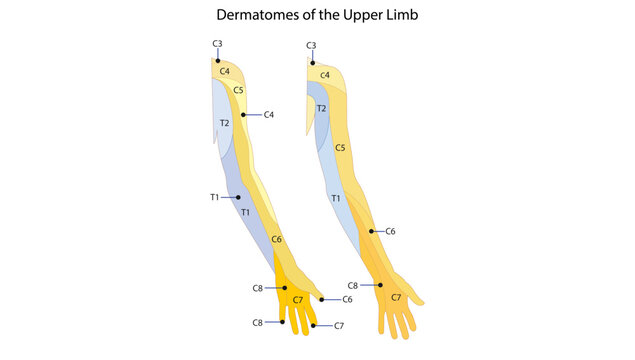 Dermatomes of the Upper Limb, the dermatomal distribution of cervical and upper thoracic spinal nerves across the upper limb.