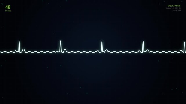 Hospital Heart Monitor Shows Flatline Signifying Patient's Critical Medical Crisis