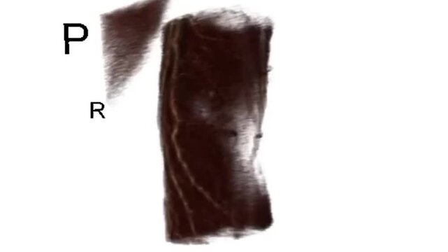 Volumetric 3D Model Render of Right Wrist Joint Architecture for Orthopedic Implant Preoperative Planning