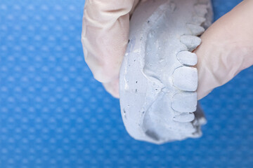 Dental Plaster Cast Held in Gloved Hand on Blue Background © SWMedia
