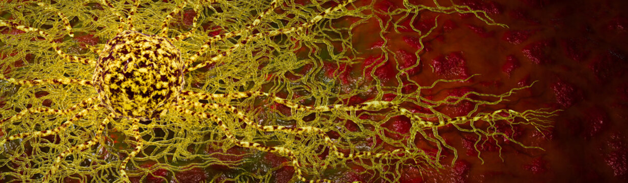 Cancer Microenvironment Showing Neovascularization Around Aggressive Tumor Cell During Angiogenesis and Progressive Tissue Invasion 3D Rendering