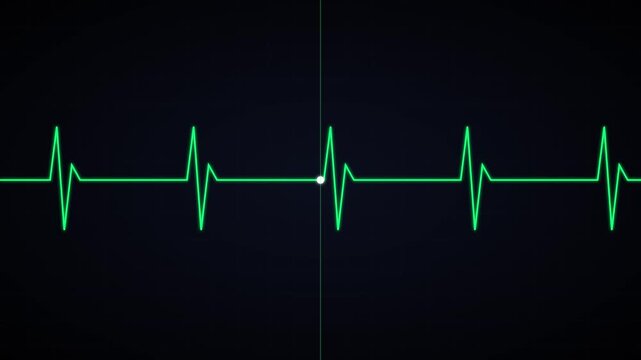 Heartbeat ekg monitor pulse line animation on dark animation background