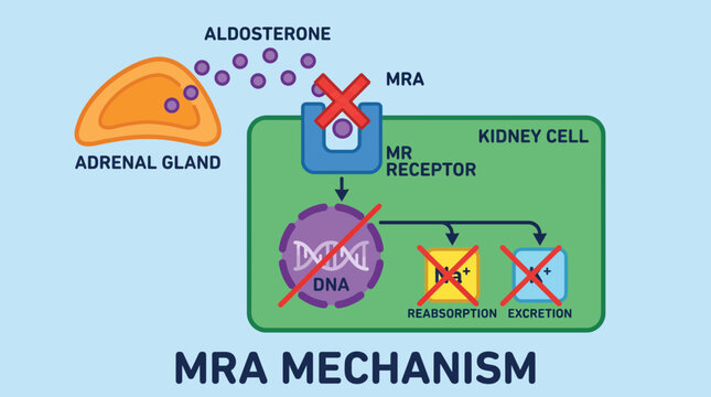 Mineralocorticoid Receptor Antagonist MRA Mechanism Vector