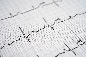 Red heart on electrocardiogram ECG with red heart, heart wave, heart attack, cardiogram report.