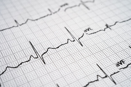 Red heart on electrocardiogram ECG with red heart, heart wave, heart attack, cardiogram report.