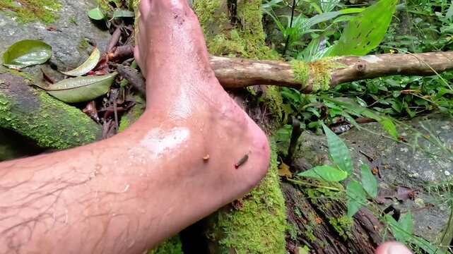 alternative, animal, antibacterial, barefoot, biology, bite, bleeding, blood, bloodsucker, bottle, care, detoxification, disease, disinfectant, feet, fluid, foot, hand, health, health care, healthy, h