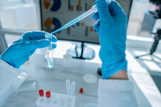 Close up of hands in protective gloves performing a laboratory experiment with a pipette and test tube. Advanced technology and scientific research tools are present on the workbench
