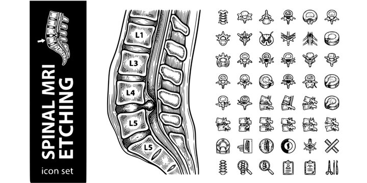 Spinal MRI Etching Black White-Vertebral Column Disc Herniation Cord-Spine Imaging Vector-Spine Icon Etching-Medical Imaging Design Set
