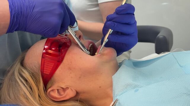 Complete dental filling procedure with patient dentist microscope anesthesia rubber dam and modern restorative treatment set. professional dental care.