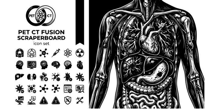 PET CT Fusion Scraperboard Black White-Metabolic Hotspot Tracer Stage-Nuclear Imaging Vector-PET Icon Scraperboard-Medical Imaging Design Set