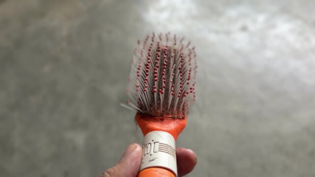 A woman&rsquo;s hand holds a hairbrush filled with fallen strands, showing excessive hair loss from thinning, weak, or damaged hair after brushing.
