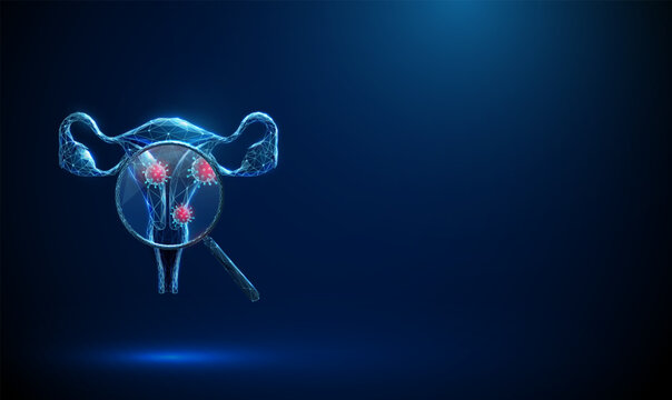 3D blue uterus and magnifying glass with viruses inside. Gynecology, viral infection, HPV diagnosis, women health, sexual disease, pathogen virus detection concept