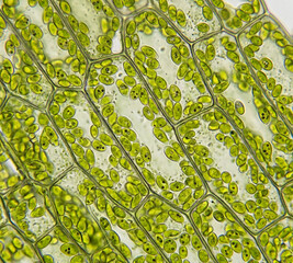 Microscopic observation of Elodea leaf cells. © BAROU ABDENNASER