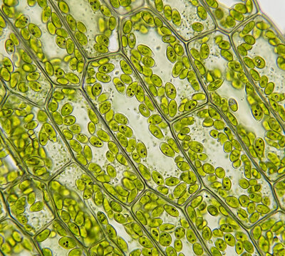 Microscopic observation of Elodea leaf cells.