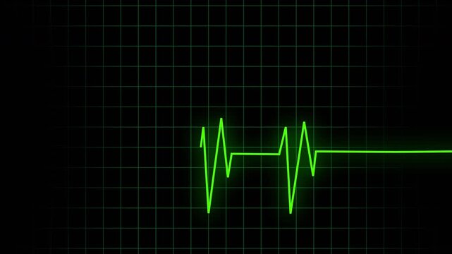 Ekg Heartbeat  line Neon Green Heart Beat animation on grid background . Electrocardiogram show heart beat line icon animated 4K video