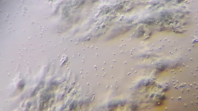 Yogurt bacteria under microscope 