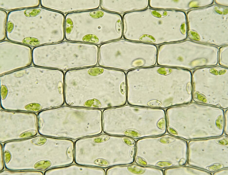 Elodea leaf cells in the dark under a microscope