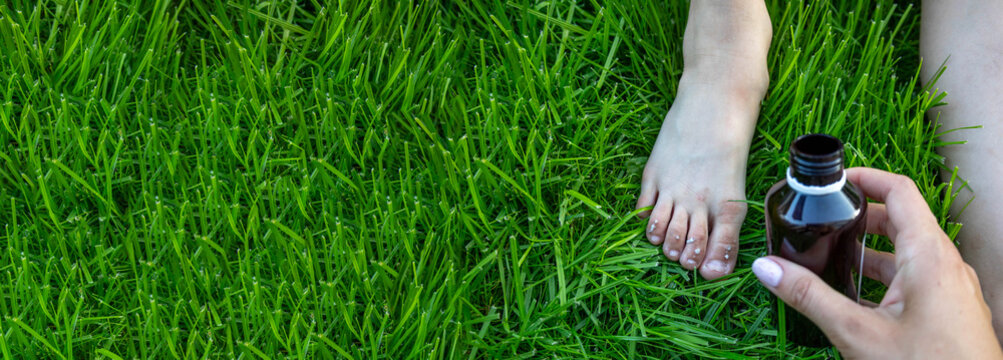 Treating a child's scratched toes with antiseptic on green grass