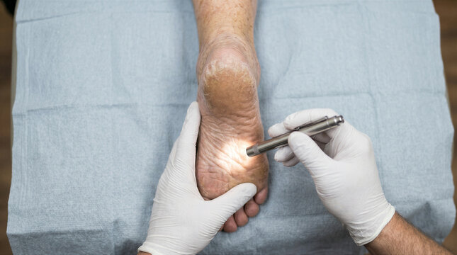 Closeup of a doctor examining a patients foot with a penlight in a medical clinic