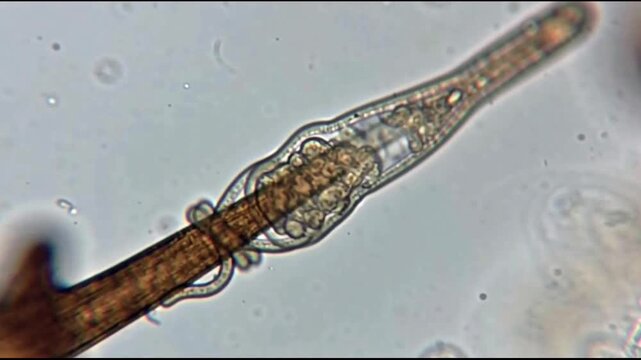 Microscopic view of a parasite worm.