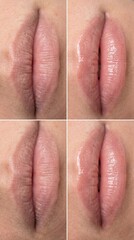 Naklejka premium Dry lip lip care hydration before and after close up natural healthy skin cosmetic beauty repair clinical
