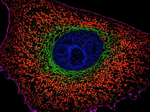 Mitochondria Inside Human Cell Fluorescence Microscopy &mdash; Cellular Energy Biology Research
