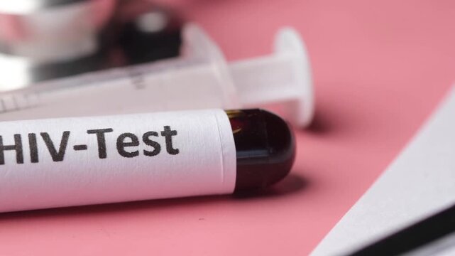 Close-up of a blood sample tube labeled HIV Test used for laboratory screening, infectious disease diagnosis, medical research, and healthcare testing.