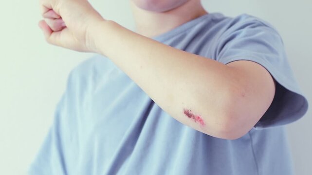 Young boy showing a scraped elbow with a fresh bloody wound after an accident, isolated on a white background. Childhood injury and healthcare concept requiring first aid treatment
