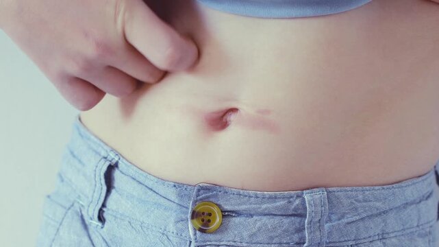 Boy lifts his shirt to reveal his stomach and shows an iron burn near his belly button, experiencing pain and discomfort that requires medical attention