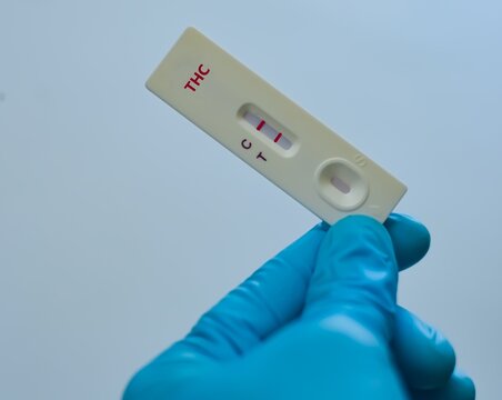 Urine sample of patient negative result for THC.
