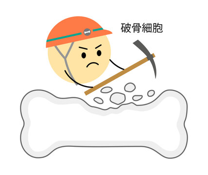 破骨細胞の働きを表すイラスト
