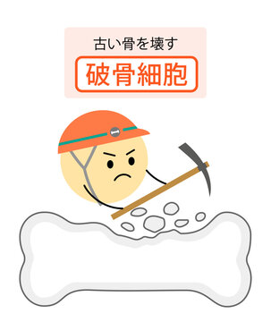 破骨細胞の働きを表す説明イラスト